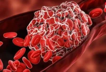 World Thrombosis Day 2026