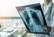 International Day of Radiology 2026