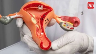Non Surgical Fibroid