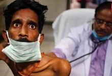 Tuberculosis symptoms