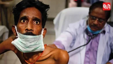 Tuberculosis symptoms