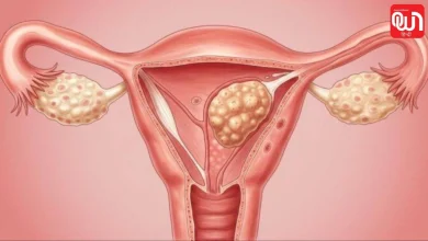 Uterine Fibroids: महिलाओं में तेजी से बढ़ रही Fibroids की समस्या! क्या बिना सर्जरी के गर्भाशय की गांठ हो सकती है ठीक? 8 Uterine Fibroids