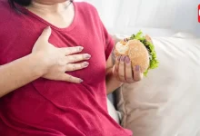 Acid Reflux
