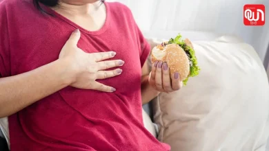 Acid Reflux