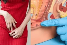 Vaginal Burning Causes