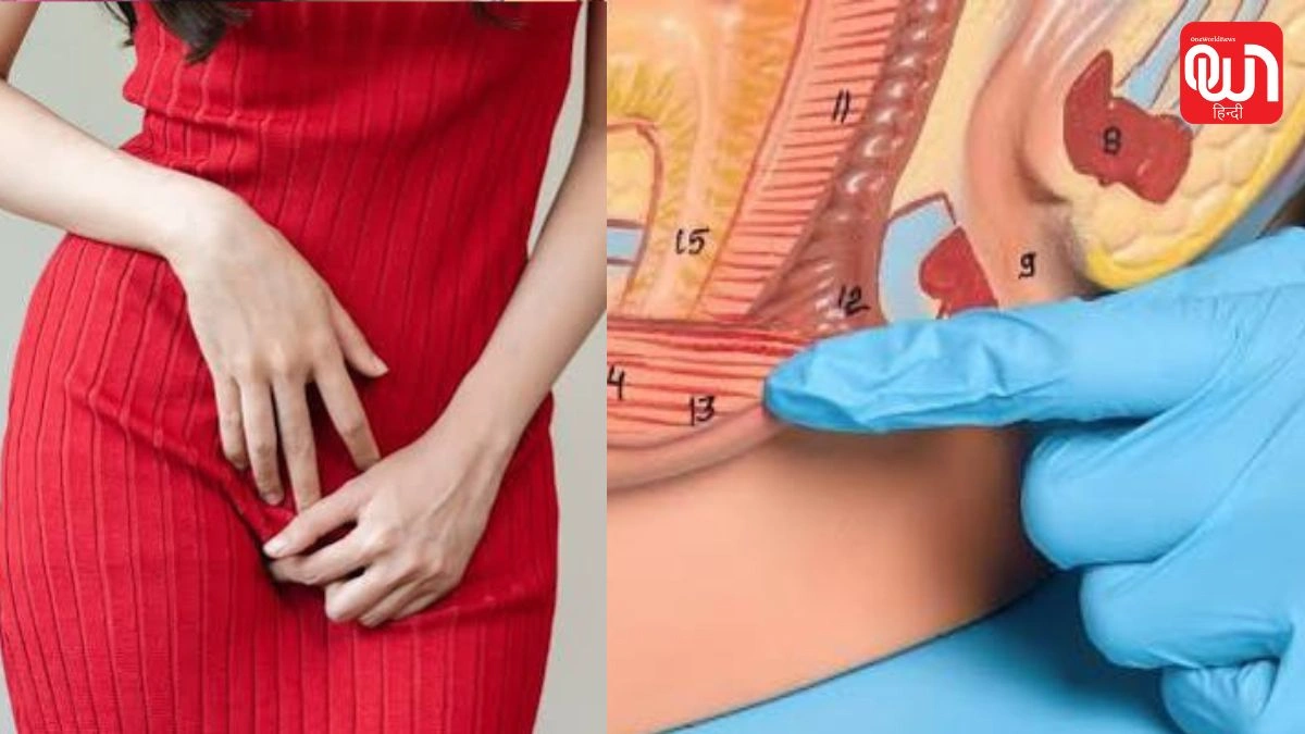 Vaginal Burning Causes: बार-बार वजाइनल जलन की शिकायत? इन 7 चीजों से दूरी बनाना हो सकता है फायदेमंद 1 Vaginal Burning Causes