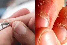 Nail care tips