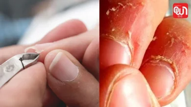 Nail care tips