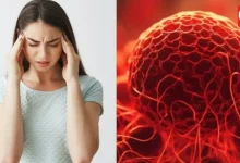 Iron Deficiency Symptoms