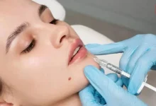 Pre-wedding beauty treatments