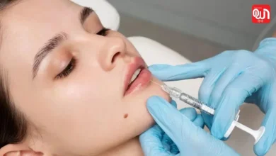 Pre-wedding beauty treatments